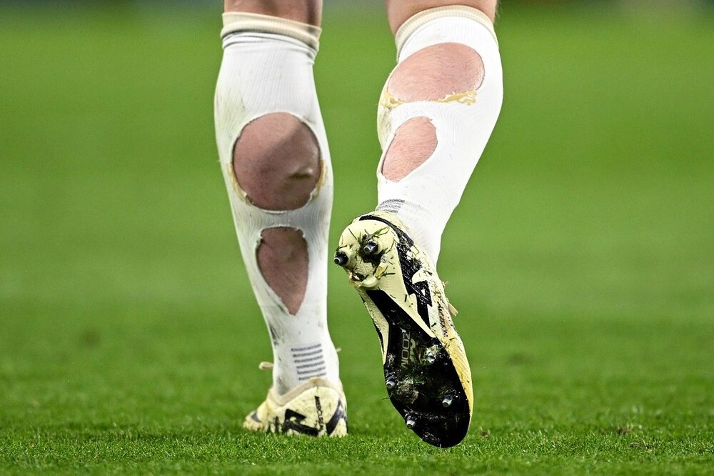 Рваные гетры